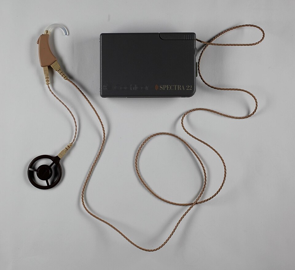 Cochlear implant