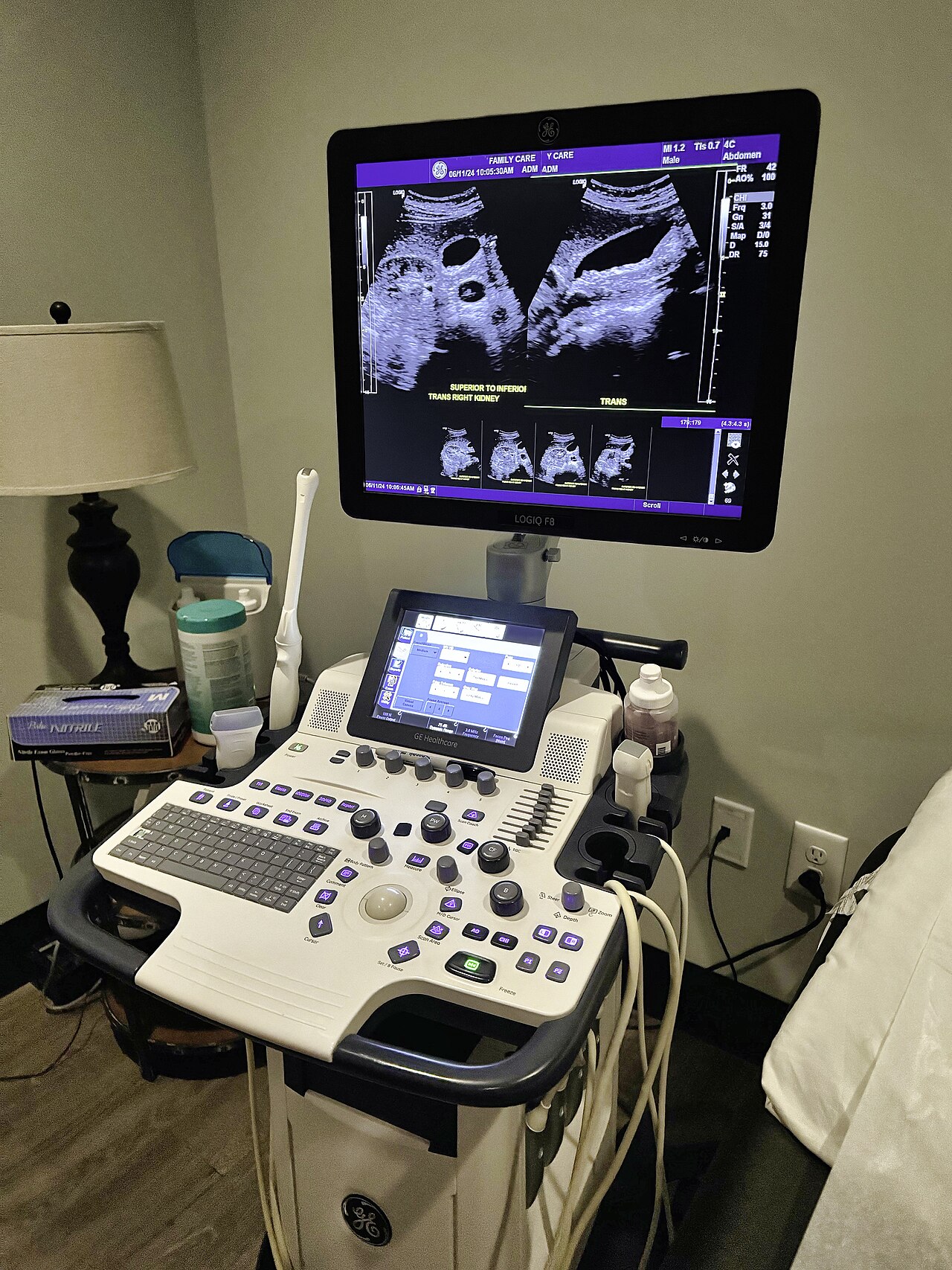 Ultrasound scanner
